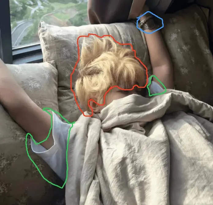 Circle-guided local editing reference image for Qwen-Image-2.1
